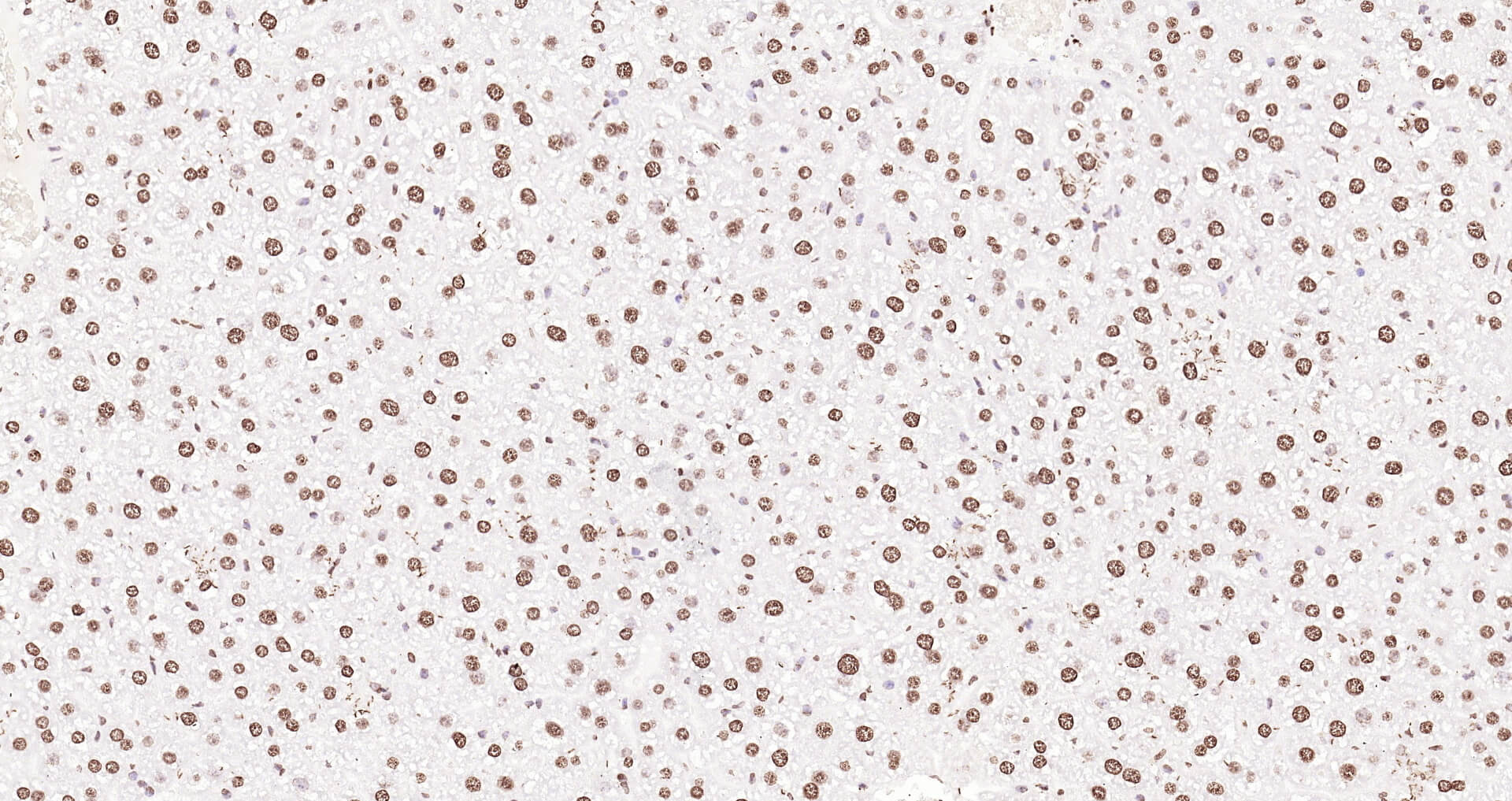 组蛋白H3（核内参）即用型免疫组化试剂盒-IHC0102